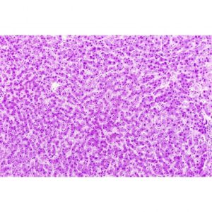 Foie sain, homme (témoin)